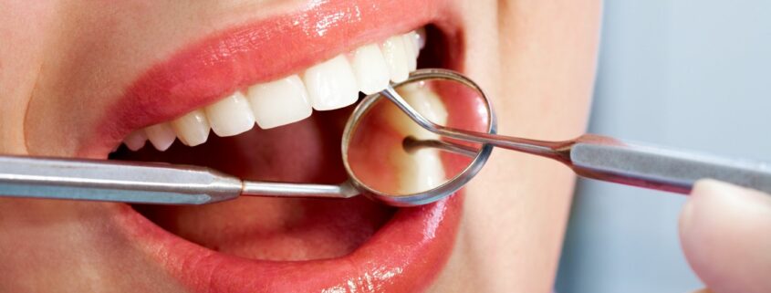 prevenir caries dental